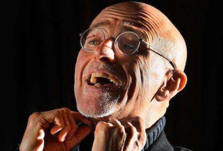 醫學奇跡再現,換頭手術最新消息揭秘!