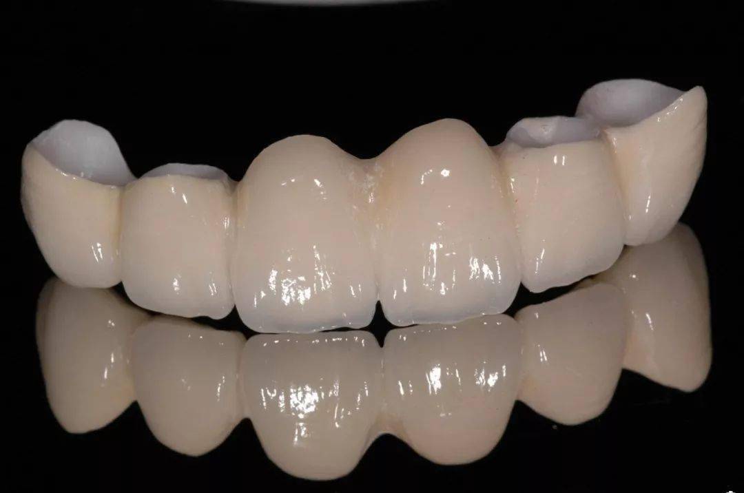 烤瓷牙和全瓷牙價格,探索學(xué)習(xí)與變化的魅力之旅