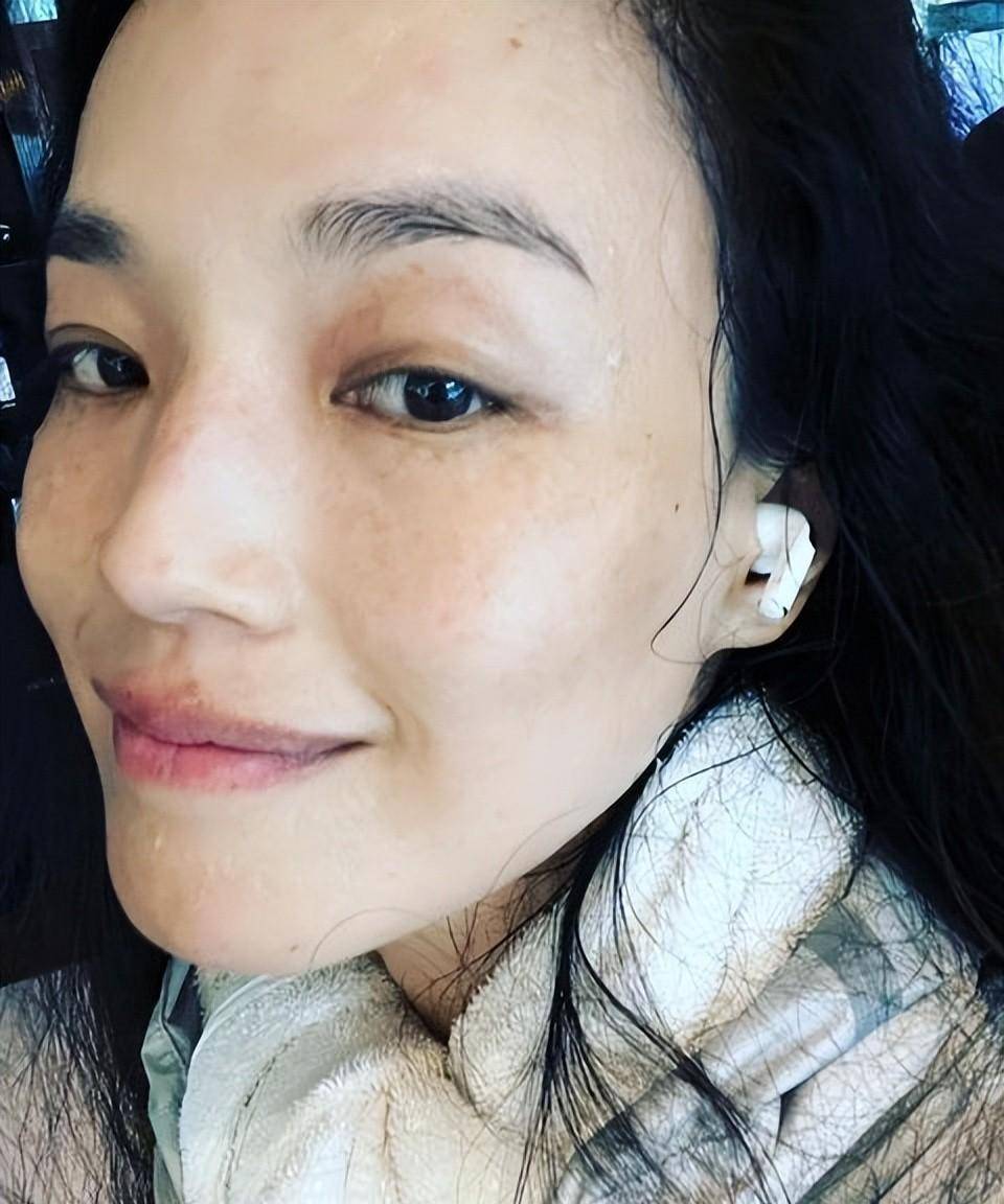 審美多元下的獨特魅力，雀斑明星的自信風采