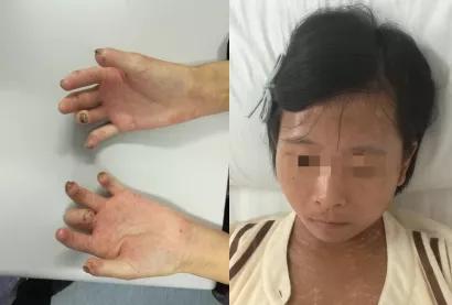 雷諾最新炫酷皮膚上線!????