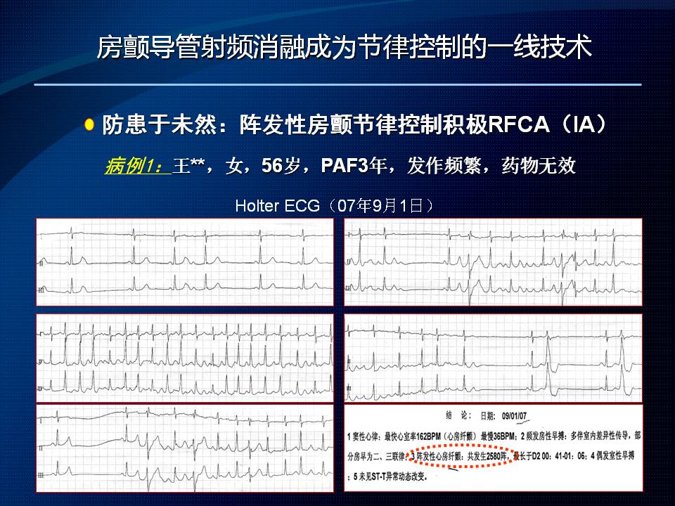 房顫吧最新資訊,全面指南助你應(yīng)對房顫挑戰(zhàn)