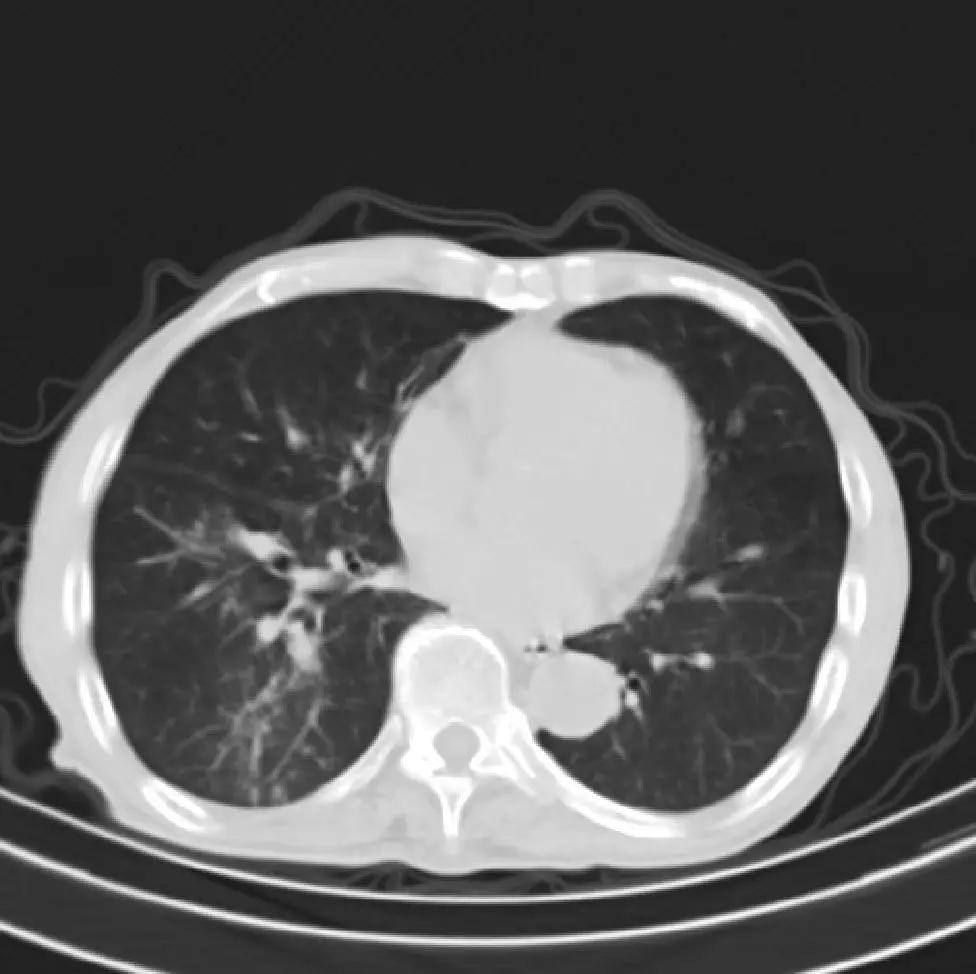 新冠狀肺炎最新動(dòng)態(tài),巷弄深處的獨(dú)特小店觀(guān)察